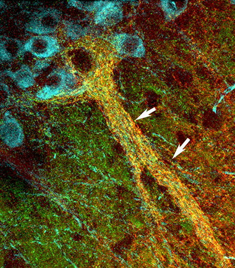 Immunolabeling of a “dendron bouquet” of axons (yellow) shown surrounding a dopamine neuron (blue) in the mouse midbrain