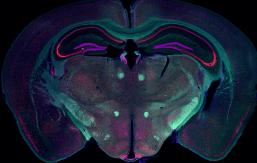 Image of a mouse’s cerebellum