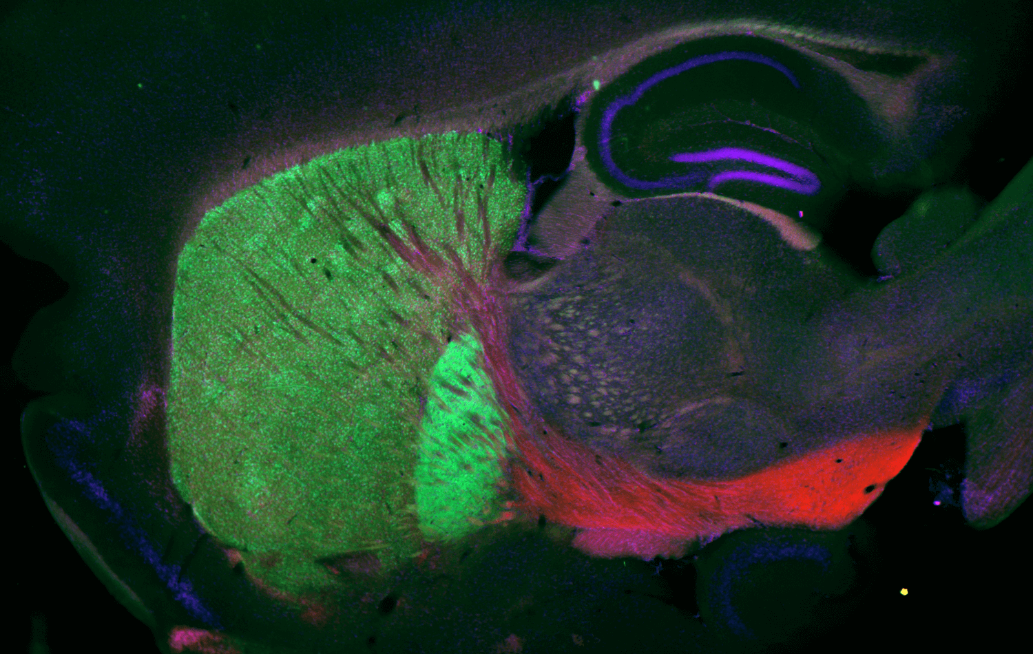 Sagittal view of a mouse brain showing various components